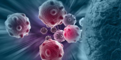 cancer cell illustration