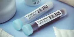 coronavirus samples concept