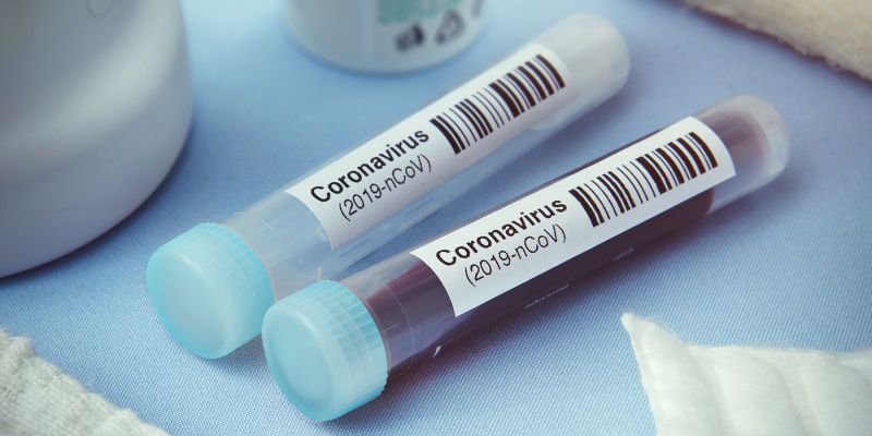 coronavirus samples concept