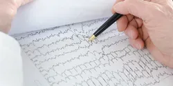 electrocardiogram