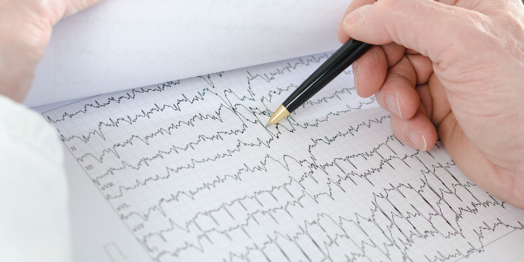 electrocardiogram electrocardiogram