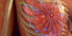 metastatic breast cancer illustration