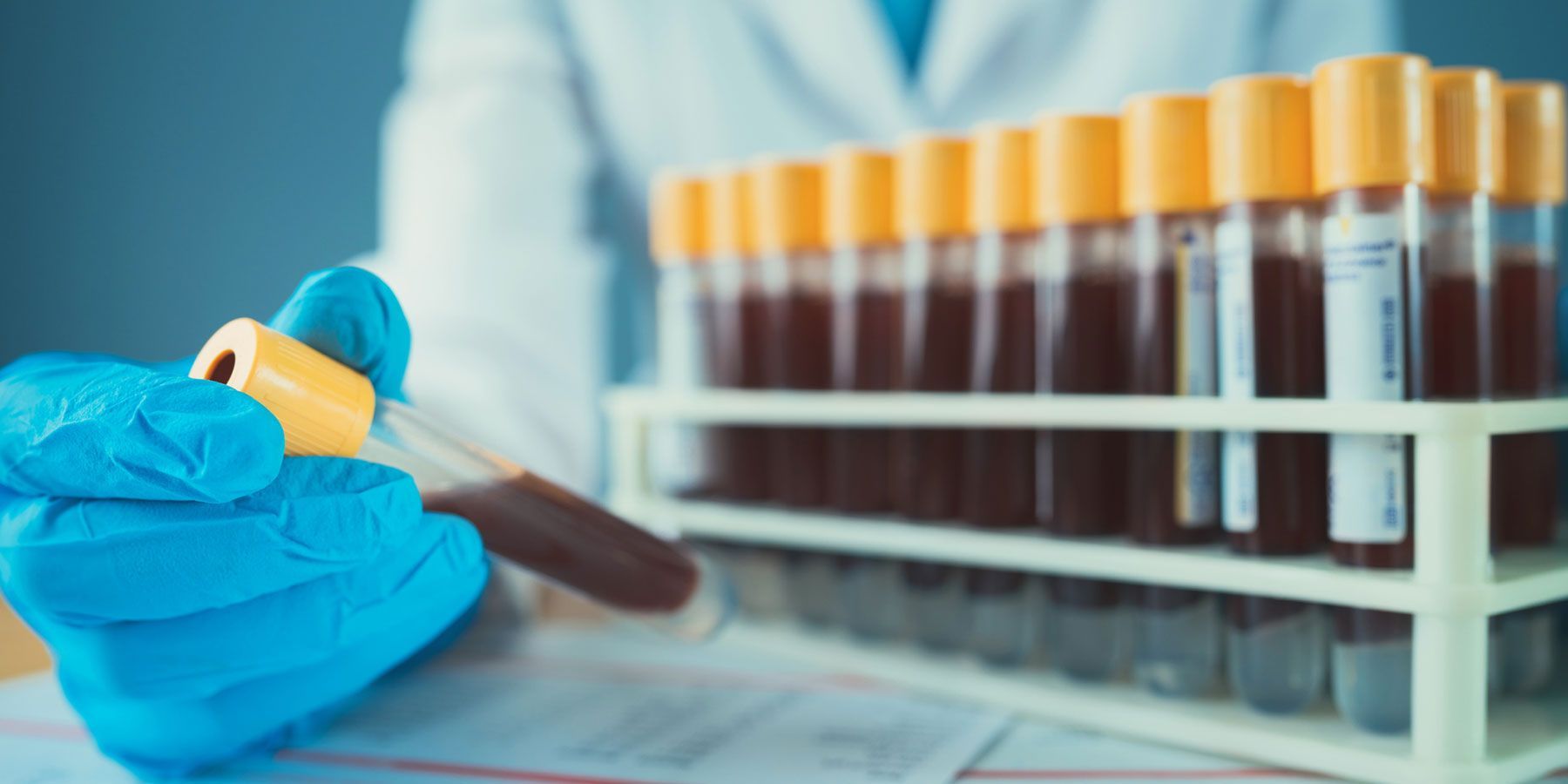 Blood Tests Blood Tests