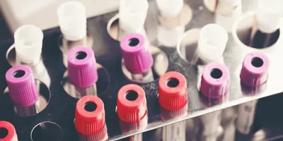 Why We Should Trust Registered Clinical Trials