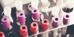 Why We Should Trust Registered Clinical Trials