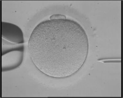 Artificial Intelligence Approach Optimizes Embryo Selection for IVF