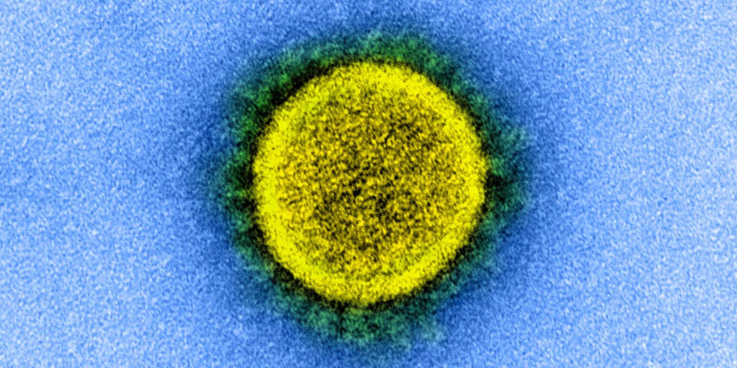 novel coronavirus, SARS-CoV-2 novel coronavirus, SARS-CoV-2
