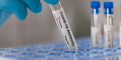 COVID-19 Antibody Test Illustrative Image
