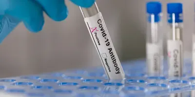 COVID-19 Antibody Test Illustrative Image