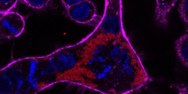 A giant cell resulting from Burkholderia infection undergoing abortive cell division.