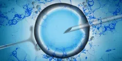 IVF Illustration