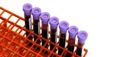 blood samples