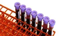 blood samples