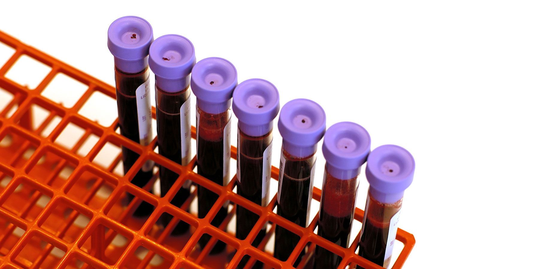 blood samples