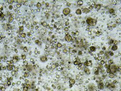 Tumor Organoids for Functional Precision Oncology