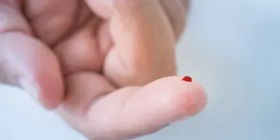 finger prick blood test