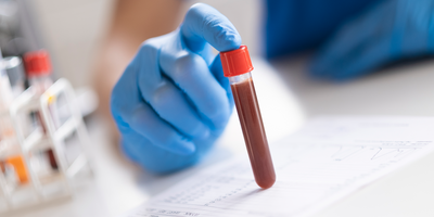 blood test sample