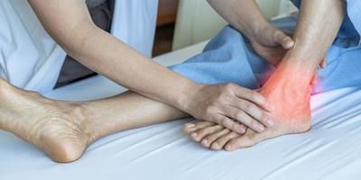 gout photo illustration