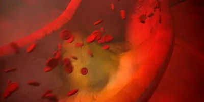 heart disease illustration