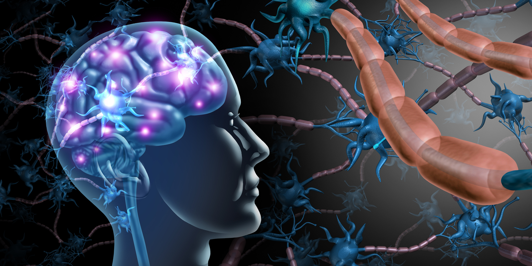 multiple sclerosis illustration