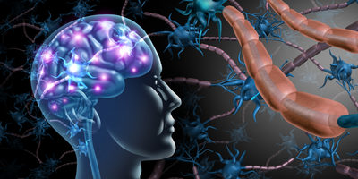 multiple sclerosis illustration