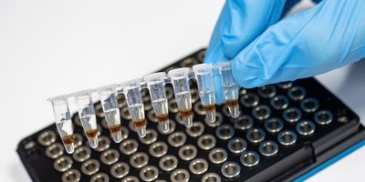 New Links Found between Diabetes Blood Markers and Alzheimer's Disease Pathology