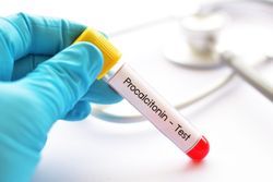 Could Procalcitonin Tests Reduce Antibiotic Use in COVID-19?