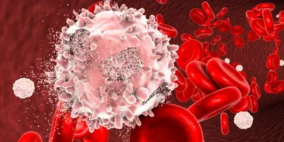 hematology