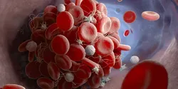 blood clot illustration