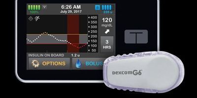 Control-IQ Artificial Pancreas System