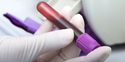 Scientists Use Blood Test to Predict Who Is Likely to Develop Psychotic Disorders