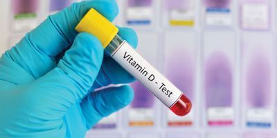 Dealing with Vitamin D
Assay Variability