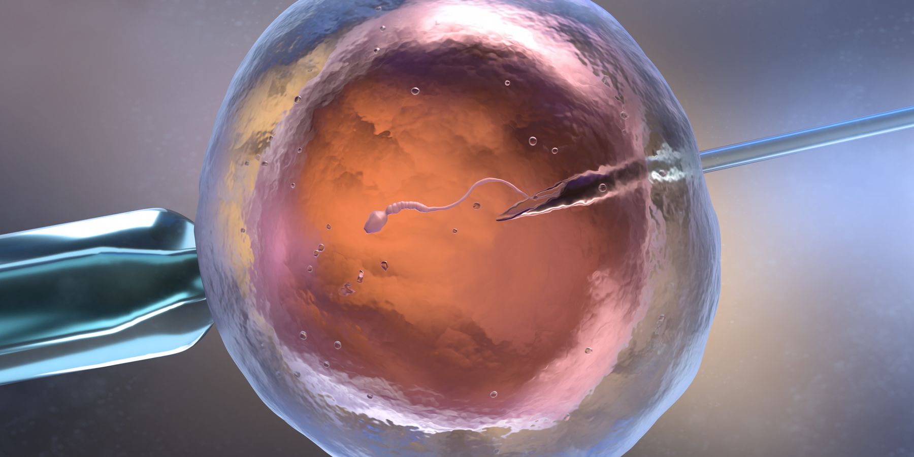 IVF Illustration IVF Illustration