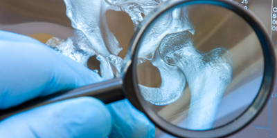 diagnosing musculoskeletal disease