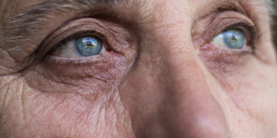 eyes of elderly woman