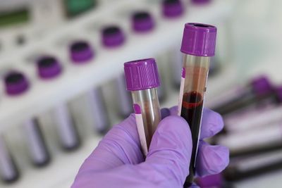 Blood Samples to Help Select the Right Early Phase Clinical Trials for Cancer Patients
