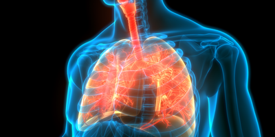 Graphic representation of lung x-ray