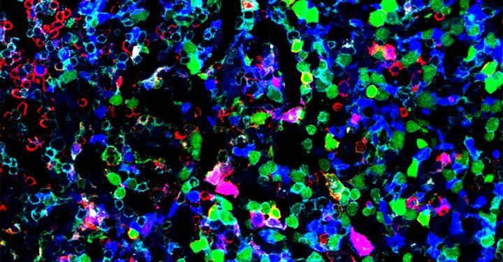 unknown ancestor of T and B lymphocytes