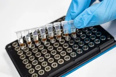 Metabolics serum test alcoholism