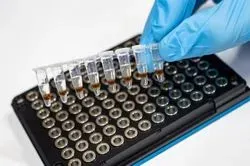Metabolics serum test alcoholism