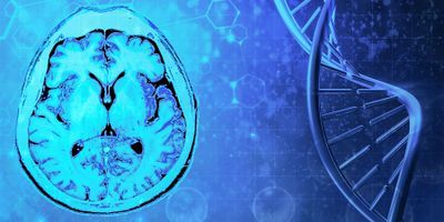 Tumor detection medulloblastoma