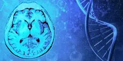 Tumor detection medulloblastoma