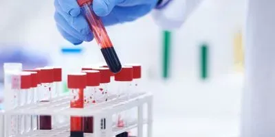 Pancreatic cancer blood test