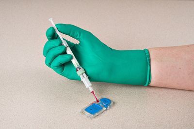 Solutions to Hemolysis in Point-of-Care Testing