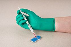 Solutions to Hemolysis in Point-of-Care Testing