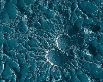 Information Technology Can Support Antimicrobial Stewardship Programs