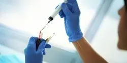 Metabolomics COVID-19