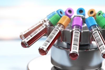 Best Lab Practices to Prevent Hospital-Acquired Anemia