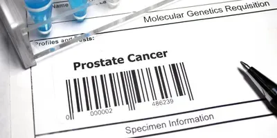 Prostate Cancer Genetic Lab Test META-16