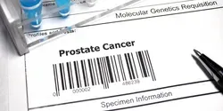 Prostate Cancer Genetic Lab Test META-16